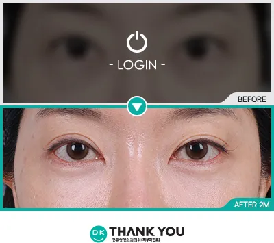 Before/After