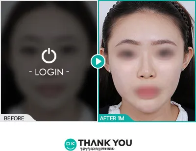 Before/After