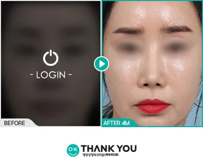 Before/After