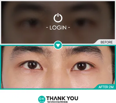 Before/After