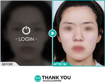 Before/After