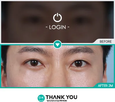 Before/After