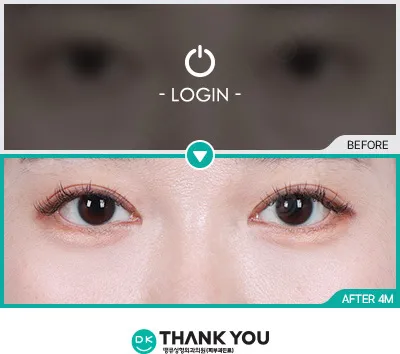 Before/After