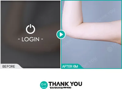 Before/After