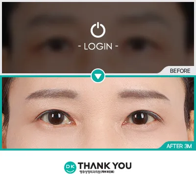 Before/After