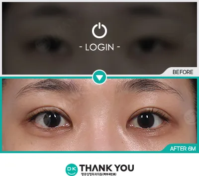 Before/After