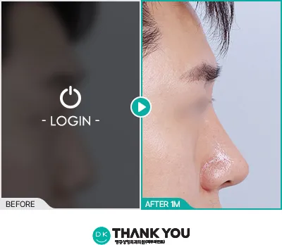 Before/After