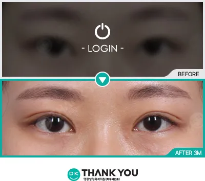 Before/After