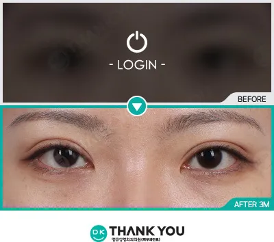 Before/After