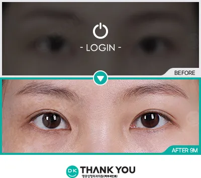 Before/After