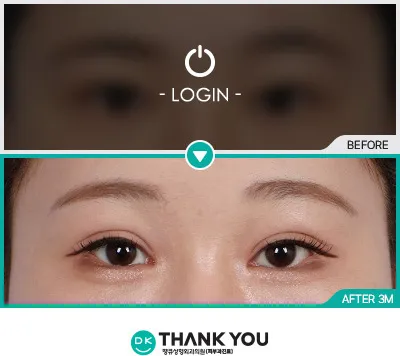 Before/After