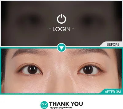 Before/After