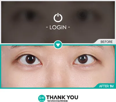 Before/After
