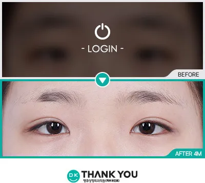 Before/After