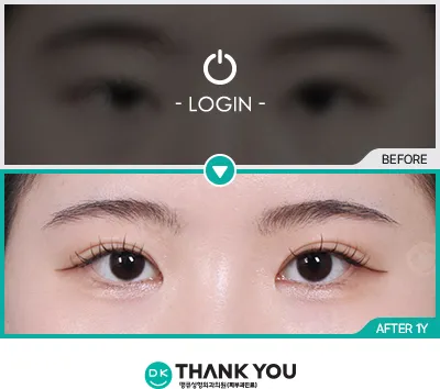 Before/After