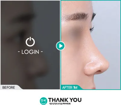 Before/After