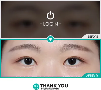 Before/After