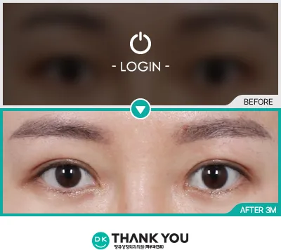 Before/After