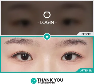 Before/After