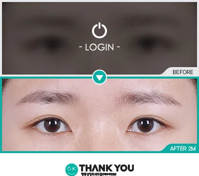 Before/After