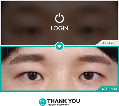 Before/After