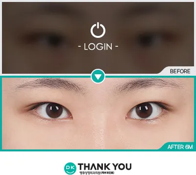 Before/After