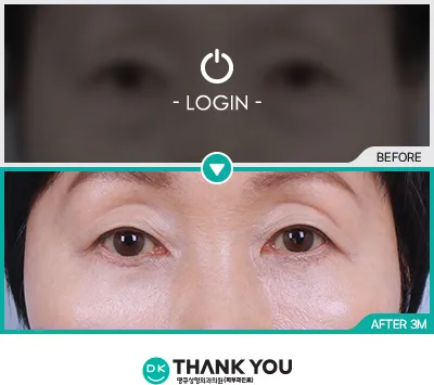 Before/After