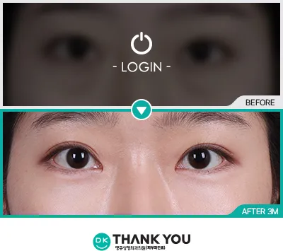 Before/After