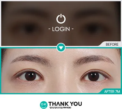 Before & After