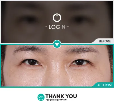 Before/After