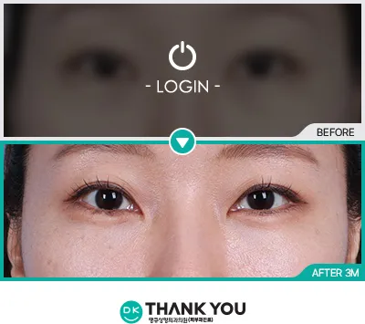 Before/After