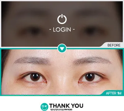 Before/After