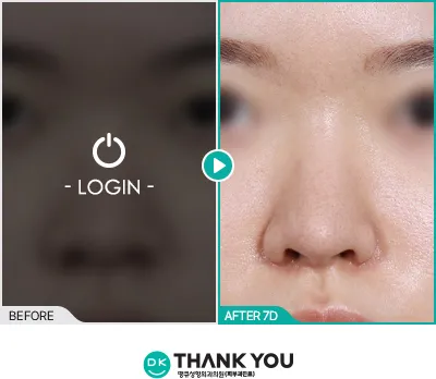Before/After
