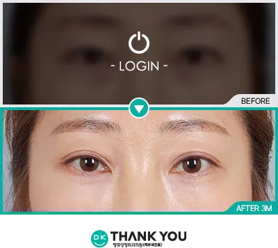 Before/After