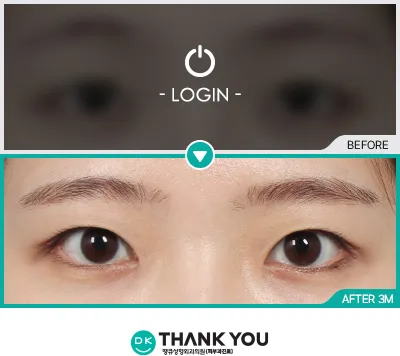 Before/After