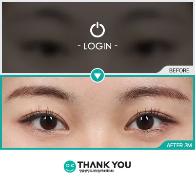 Before/After