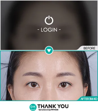 Before/After