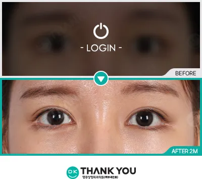 Before/After