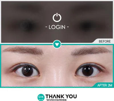 Before/After