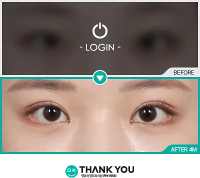 Before/After