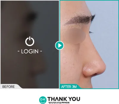 Before/After