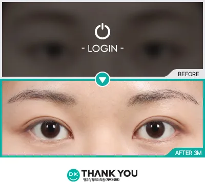 Before/After