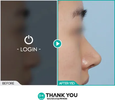 Before/After
