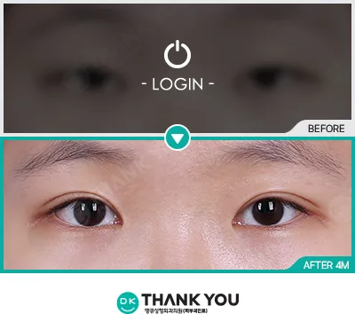 Before/After