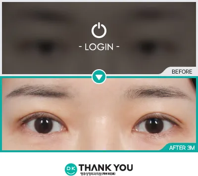 Before/After