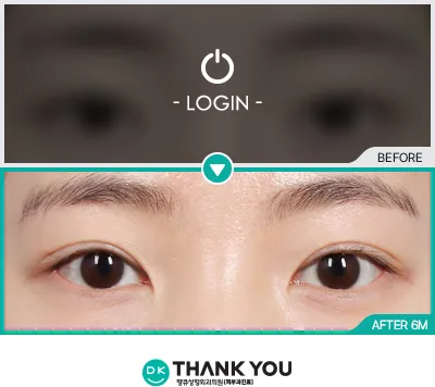 Before/After