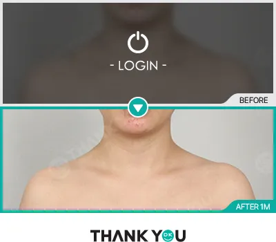 Before/After