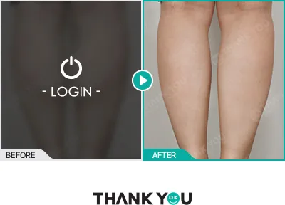 Before/After