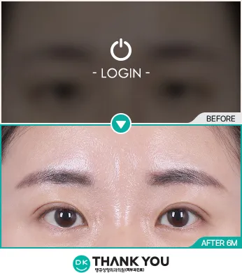 Before/After