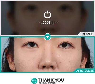 Before/After